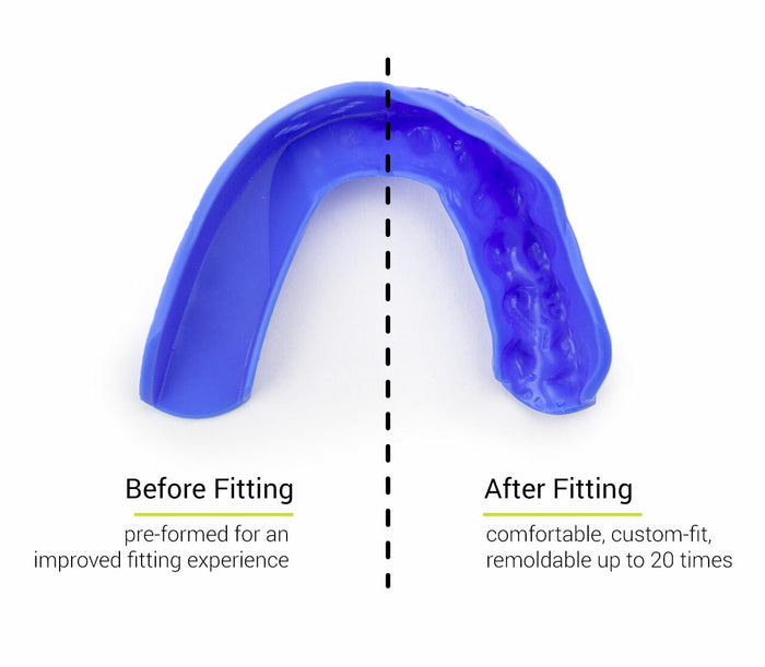 Sisu 3D Mouthpiece